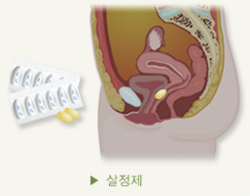 섹스할 때 콘돔만 쓰세요? 색다른 피임법 5 - 연애의 과학