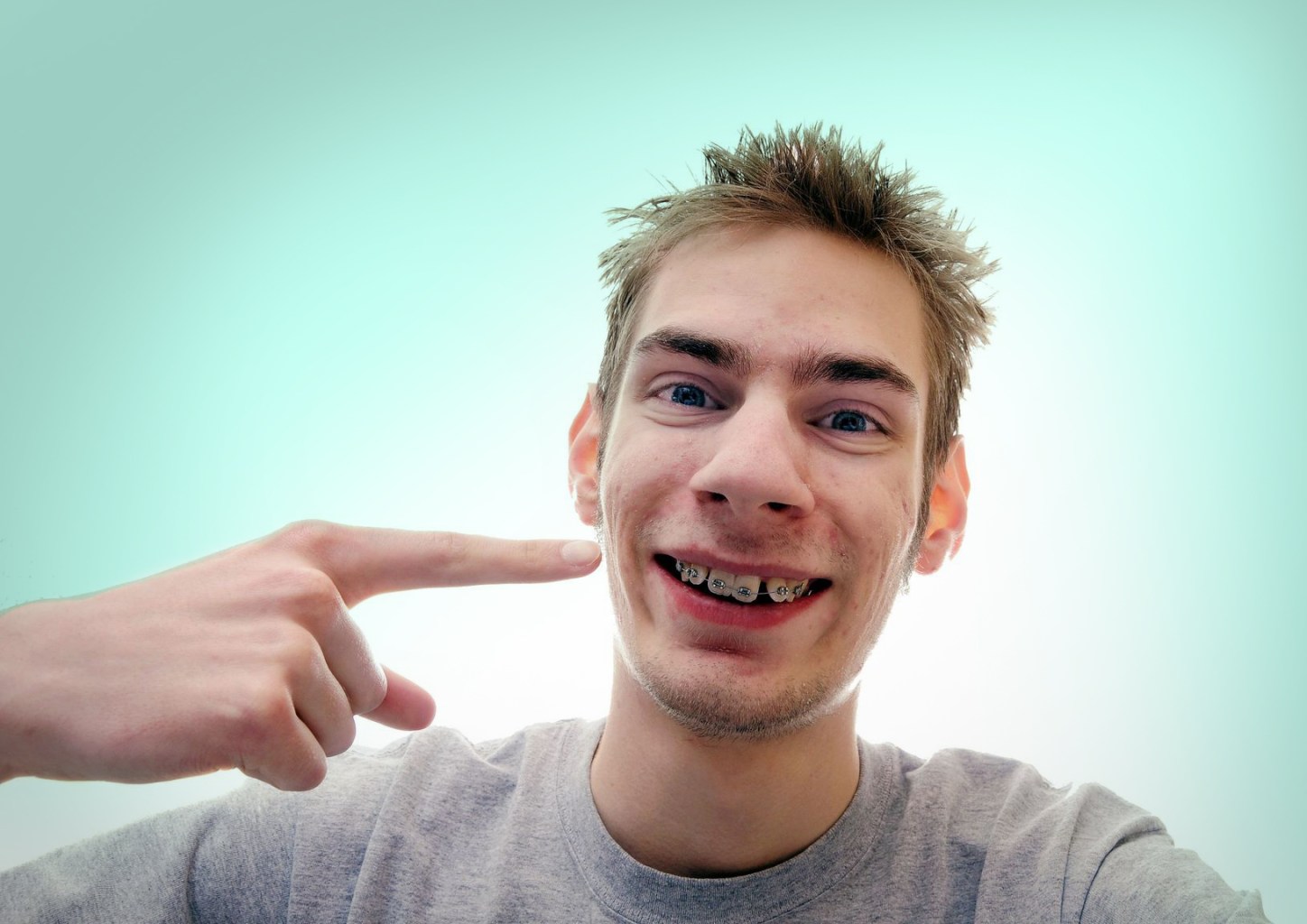 девушка улыбка. красивая улыбка. красивая улыбка. смайл праздник. голливудская улыбка виниры.